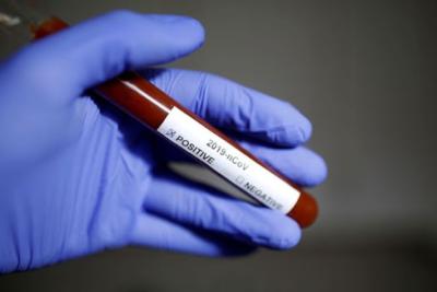 Maranhão tem 74.925 casos confirmados de Covid-19