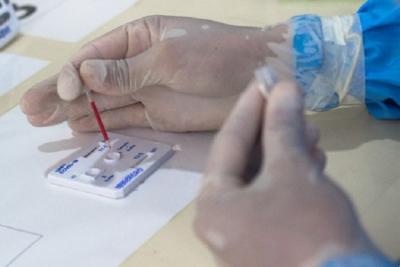 Pesquisador tira dúvidas sobre testes de Covid-19